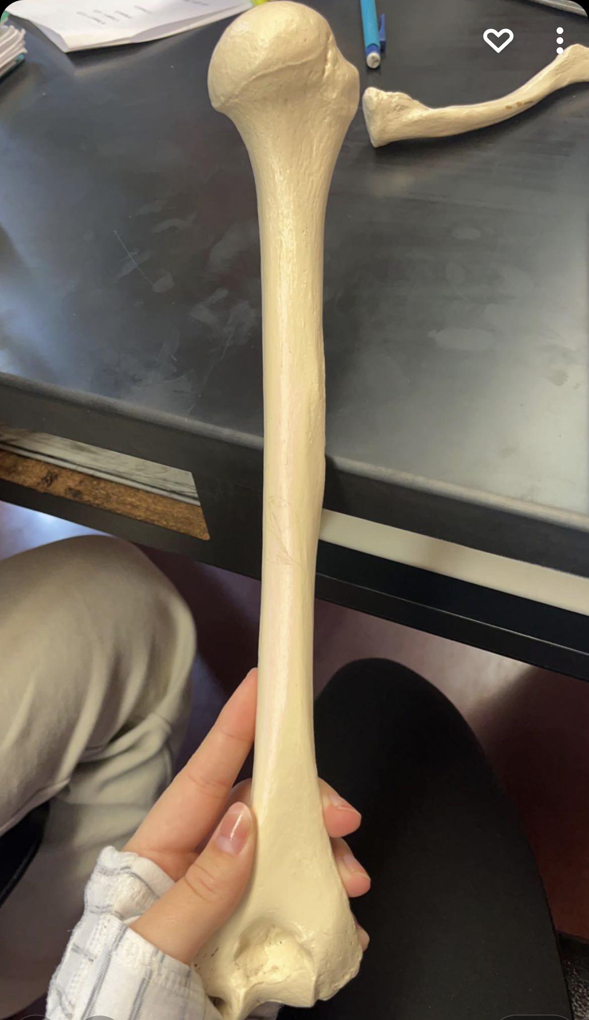 <p>Name this bone:</p>