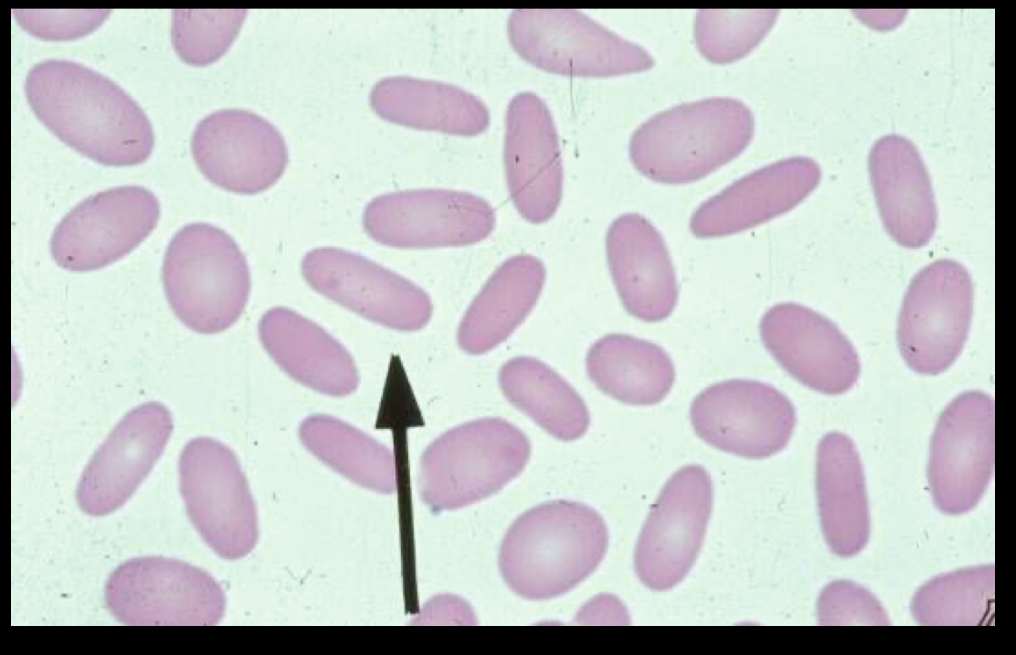 <p>What RBC is this? </p>