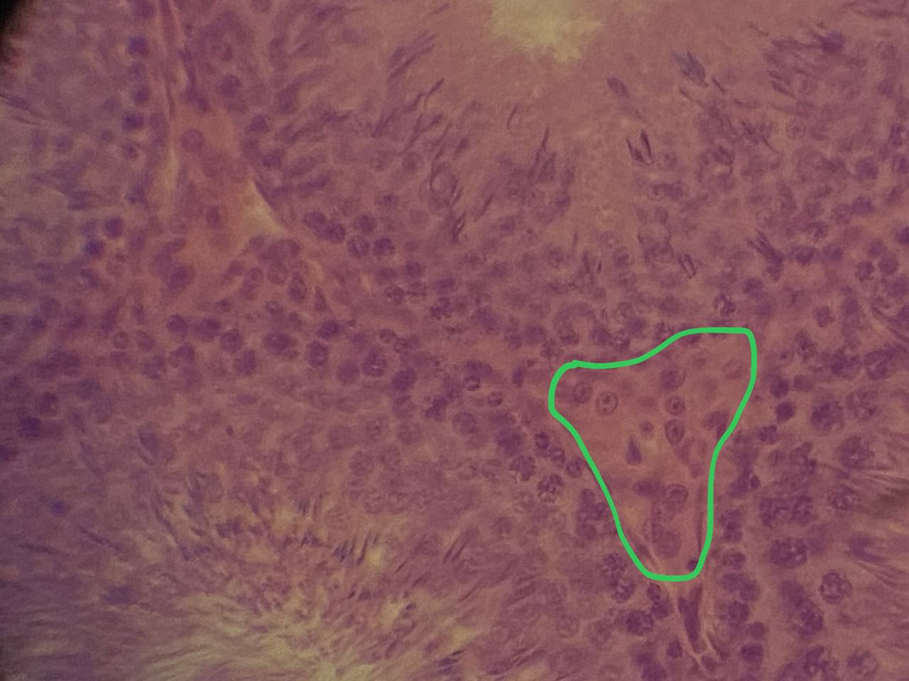 term image
