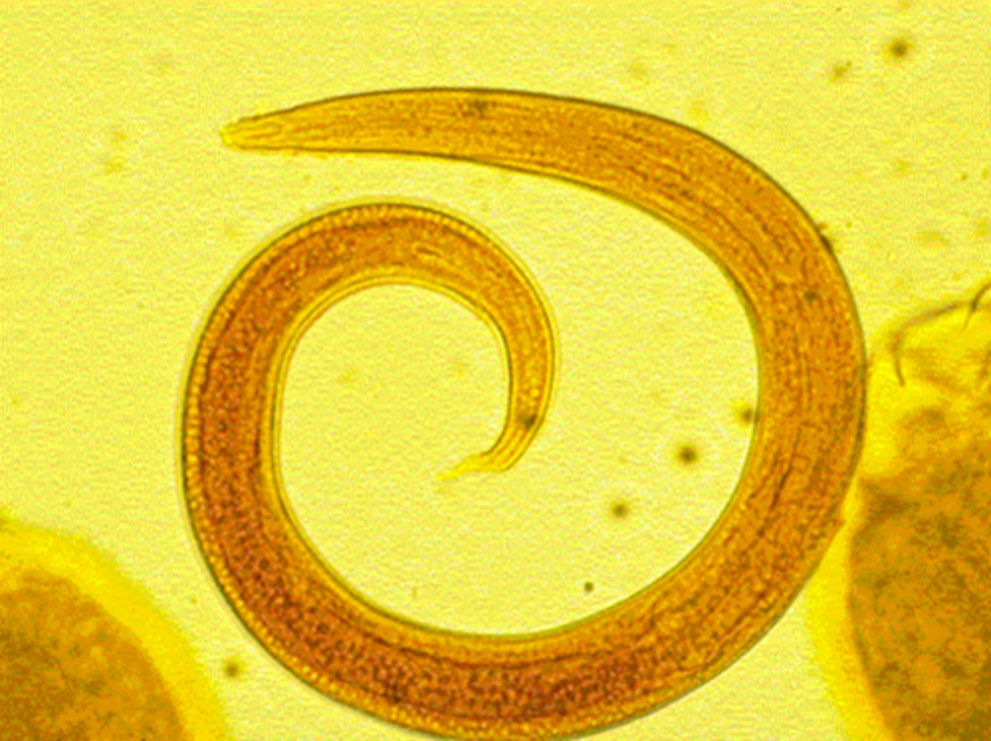 <p>parasite that has a complex life cycle</p><p>----------------</p><p>REQUIREMENTS:</p><p>- requires indirect transmission and multiple hosts</p><p>----------------</p><p>HOSTS:</p><p>- definitive host = white-tailed deer</p><p>- intermediate host = snails and slugs in grass</p>