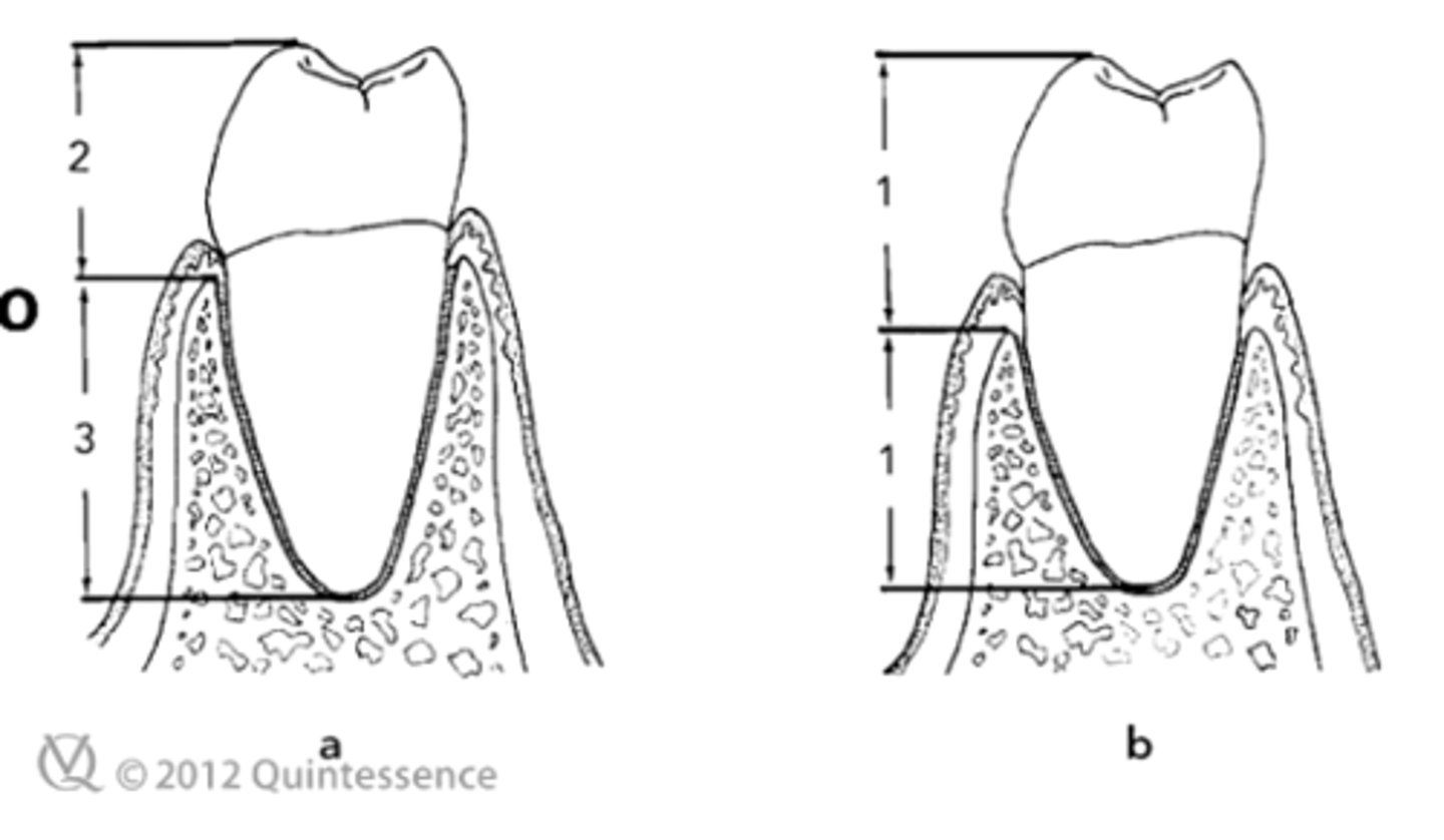 <p>The maximum acceptable crown-root ratio for a fixed partial denture abutment is _______</p>