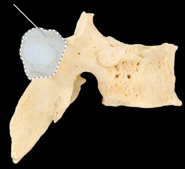<p>What part of the vertebra is highlighted?</p><p>What type of vertebra is this (which region is this vertebra from)?</p><p>(Lateral view, right side).</p>