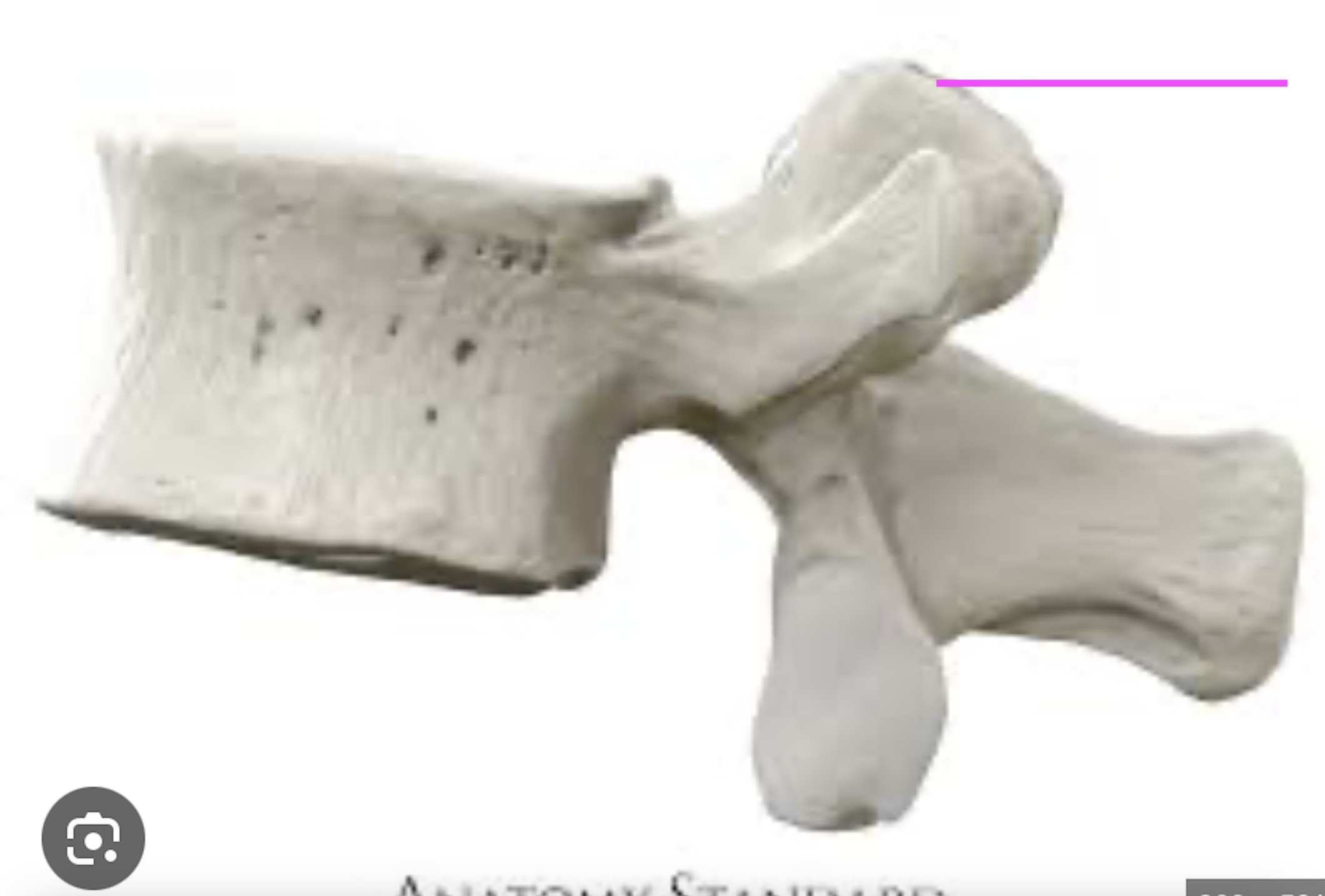 <p>What part of the vertebrae is this?</p>