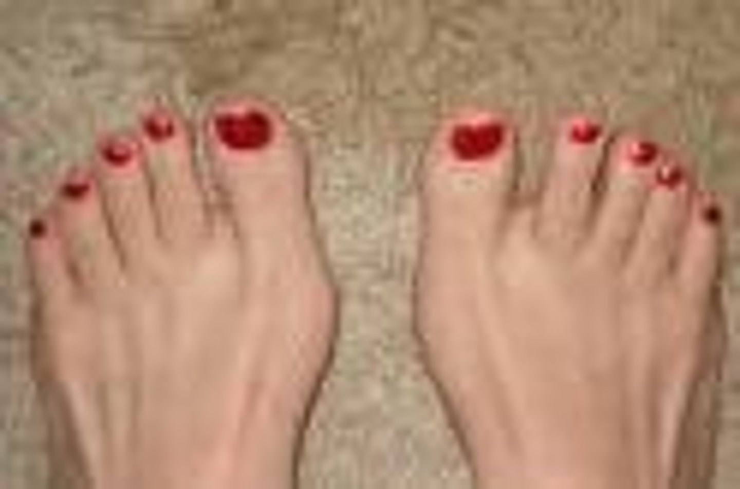 <p>toes</p>