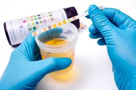 <p>What is the correct manner of collecting urine specimens for a urinalysis?</p>