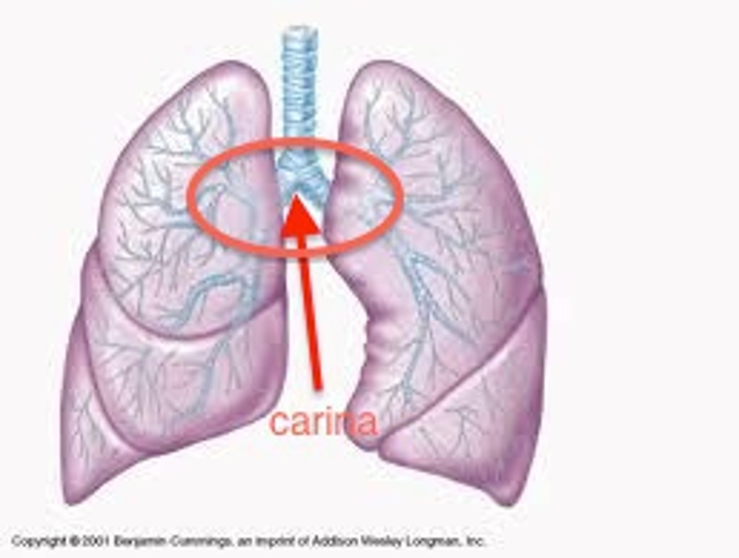<p>name this; last tracheal cartilage, very sensitive, stimulates a strong cough reflex, it is where the trachea splits  </p>