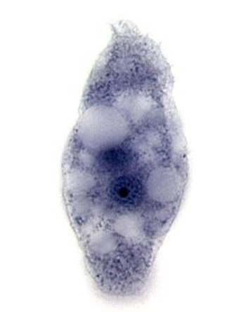 <p>whats this</p>