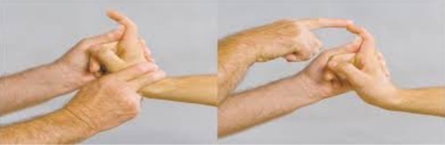 <p>tight retinacular test</p>