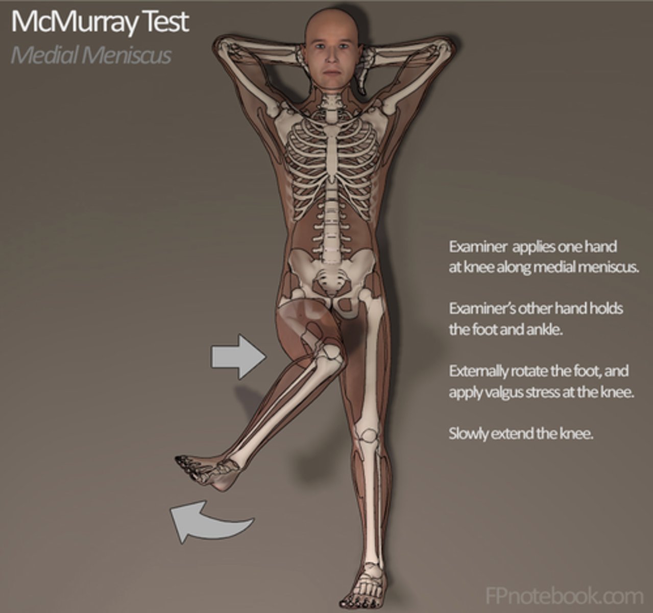 <p>meniscal tear → McMurray or Apley's compression</p><p>MOI is pivoting/rotating</p>