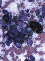 <p>Canine Melinoma</p>