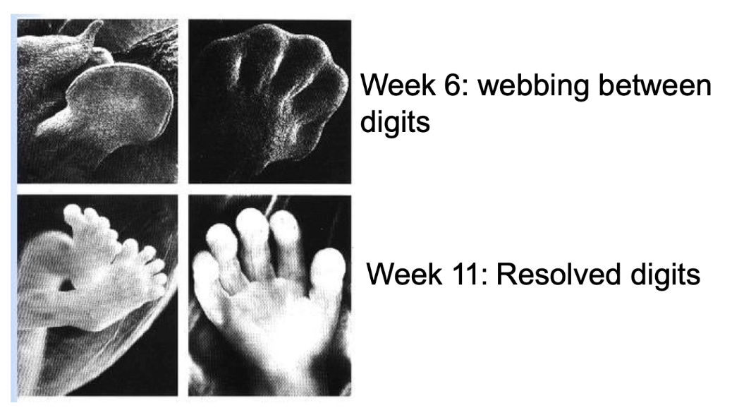 <p><strong>Shapes body structures by removing excess cells</strong></p><ul><li><p>Example: webbing between fingers/toes (week 6) removed by apoptosis (week 11)</p></li><li><p>Without apoptosis → webbing remains</p></li></ul><p></p>