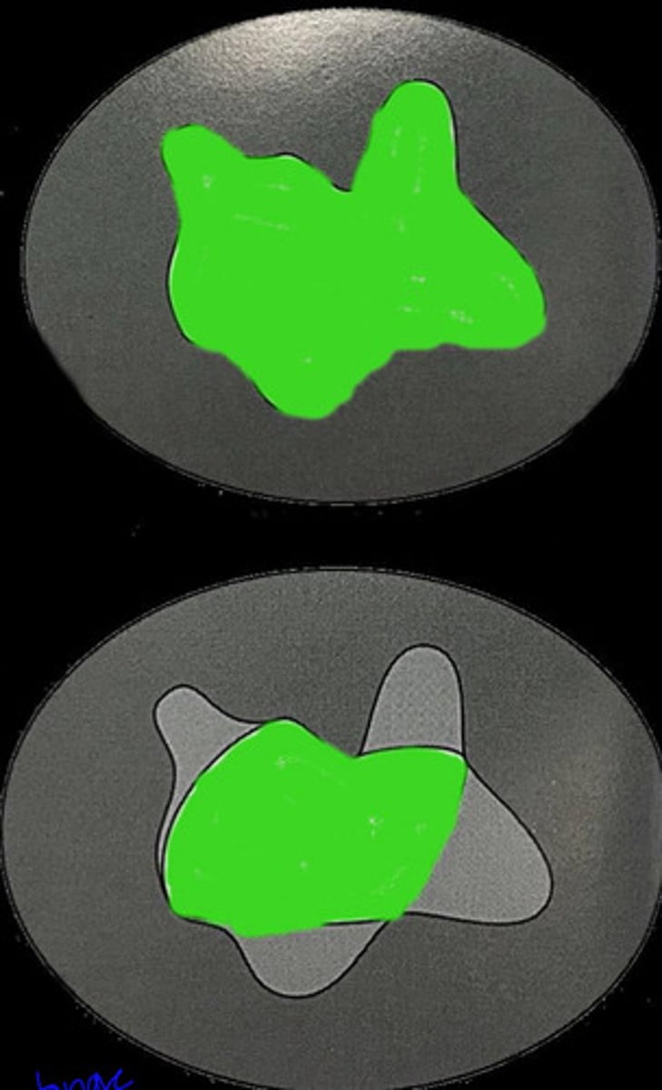 <p>What do these two appearances tell you about ulcer healing?</p>