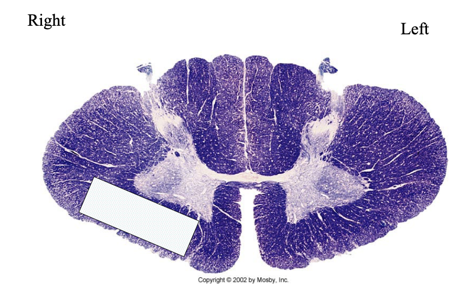 <p>What clinical findings would you expect with each of these lesions?</p>