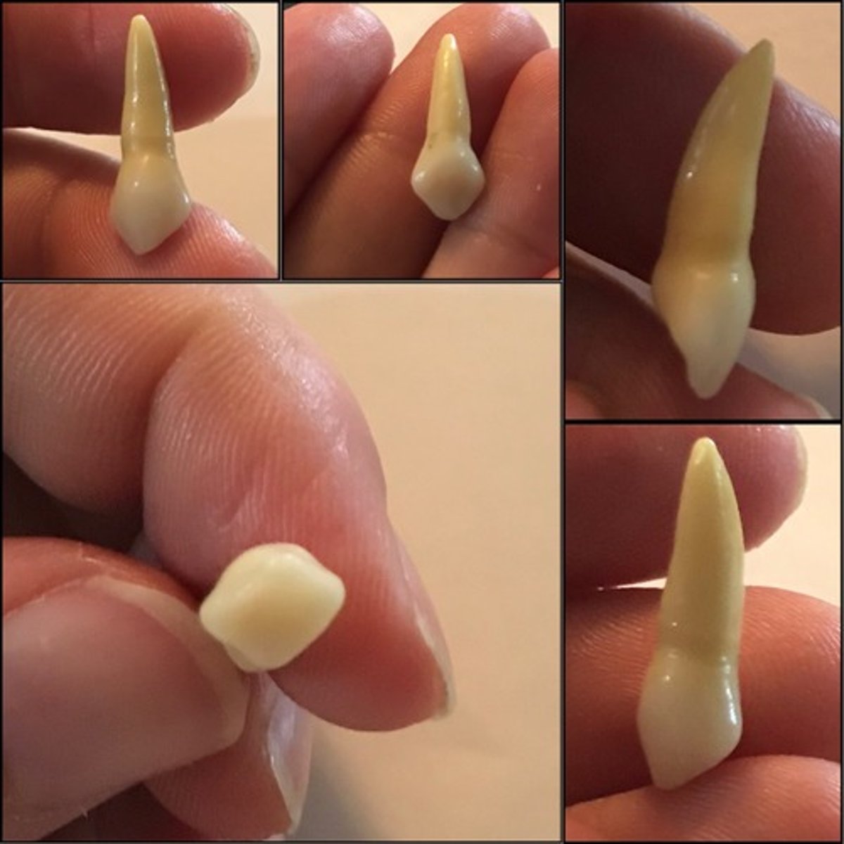 <p>What tooth is this ?</p>