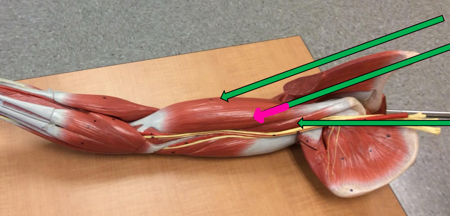 <p>Identify this muscle?</p>
