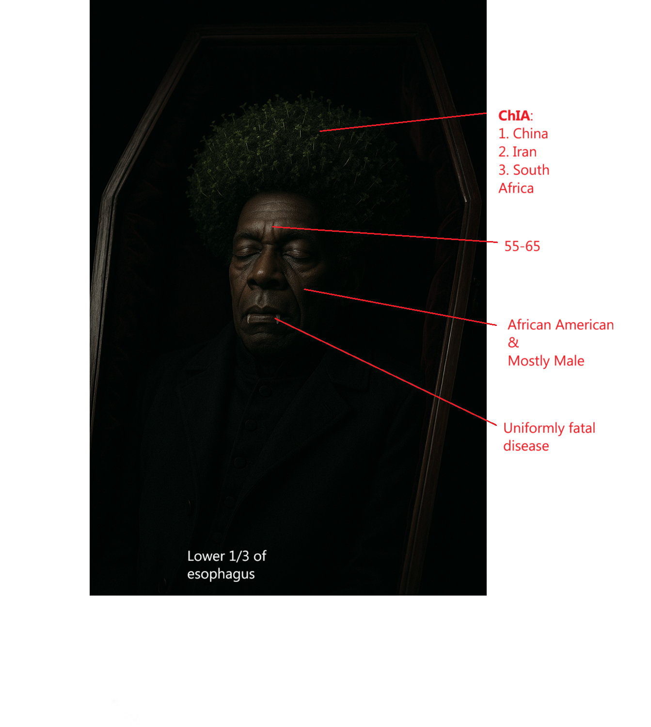 <p>Higher incidence in: </p><ol><li><p>mostly <strong>male </strong></p></li><li><p>African American </p></li><li><p>ChIA: China, Iran, South Africa</p></li></ol><p></p><p>Age</p><ol start="4"><li><p>55-65</p></li></ol><p>Location where most occur in</p><ol start="5"><li><p>lower 1/3</p></li></ol><p></p><ol start="6"><li><p>Uniformly fatal disease </p></li></ol><p></p>