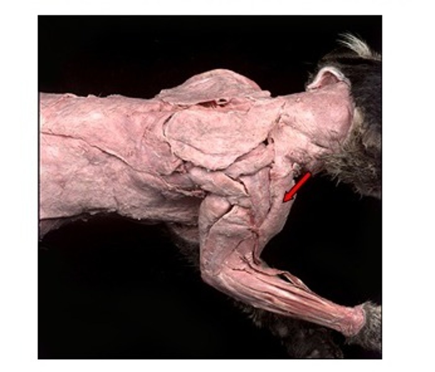 <p>Origin: clavicle</p><p>Insertion: ulna</p><p>Action: flexes forearm</p>