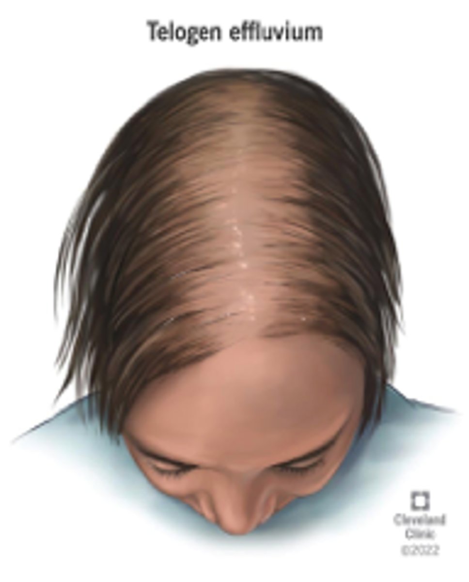 <p>uniformed hair thinning</p>