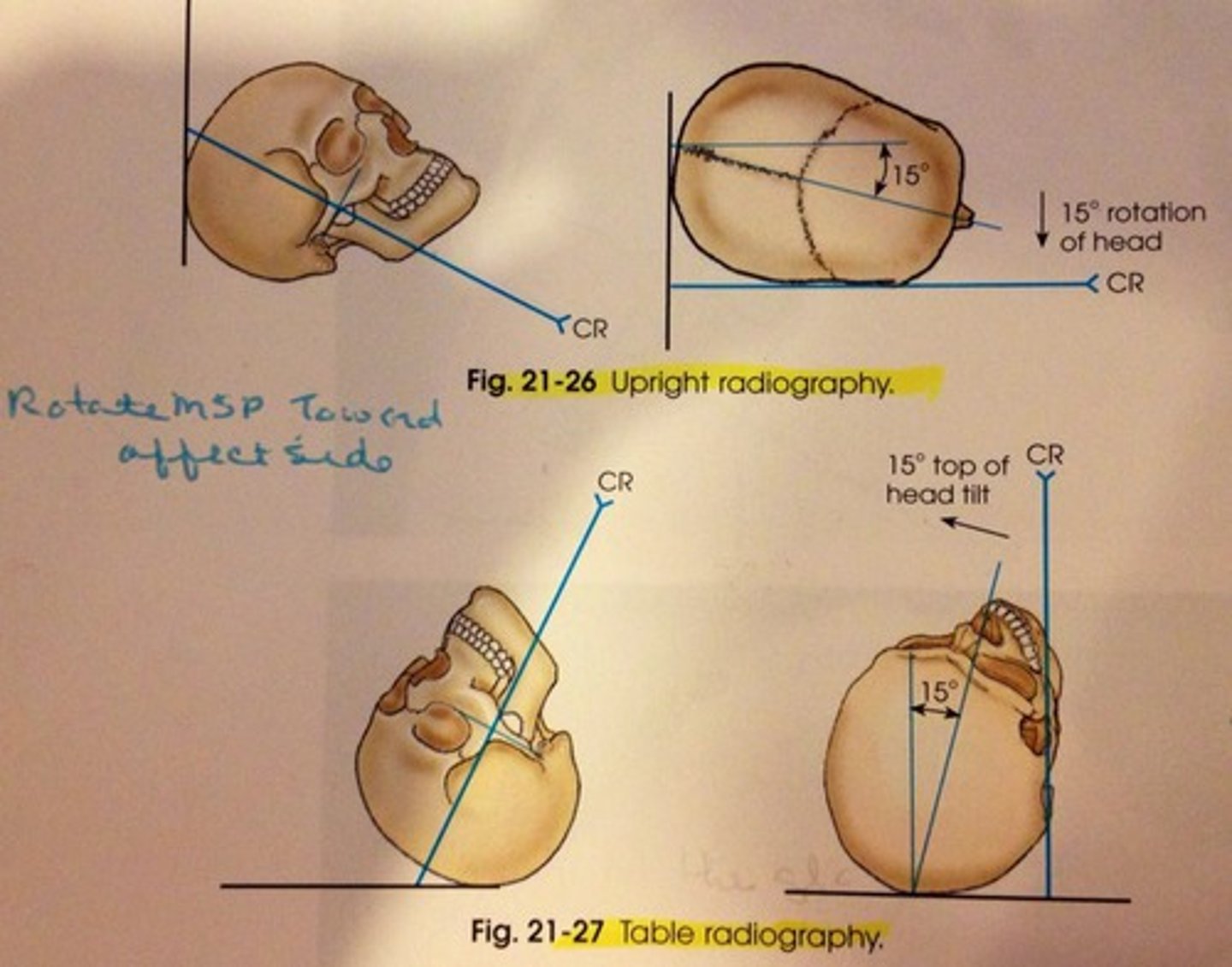 <p>means touching a curve or surface at only one point. Describes the CR that skims a body part to project the anatomy into profile and free of superimposition of surrounding body structures.</p>