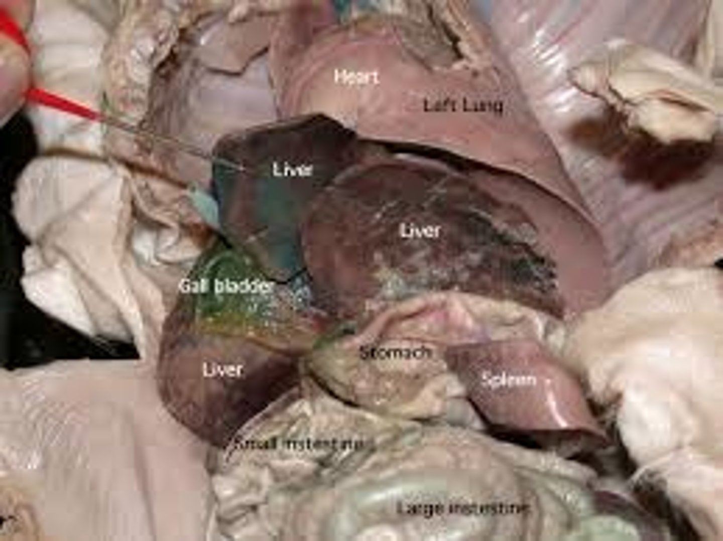 <p>where bile is stored</p>