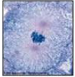 <p>Which phase of mitosis is depicted?</p>