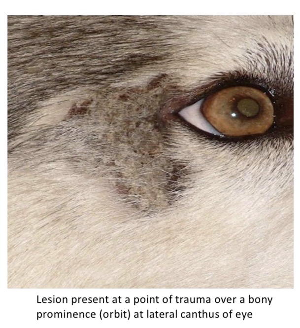 <p>Zinc responsive dermatosis - Lesion distribution </p>