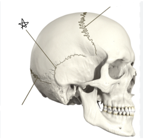 <p>what suture is the star pointing to </p>