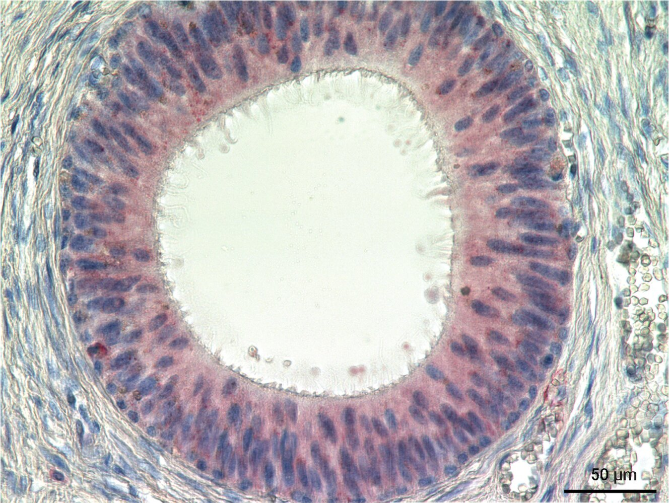 <p>8. Which statement about the structure shown in the image is correct?</p><p>A. The epithelium is particularly characteristic of the periurethral zone.</p><p>B. The epithelial cells have long cilia (kinocilia).</p><p>C. It is a glandular end piece.</p><p>D. It is a transitional epithelium.</p><p>E. Below the basement membrane of the epithelium lie myofibroblasts or smooth muscle cells.</p>