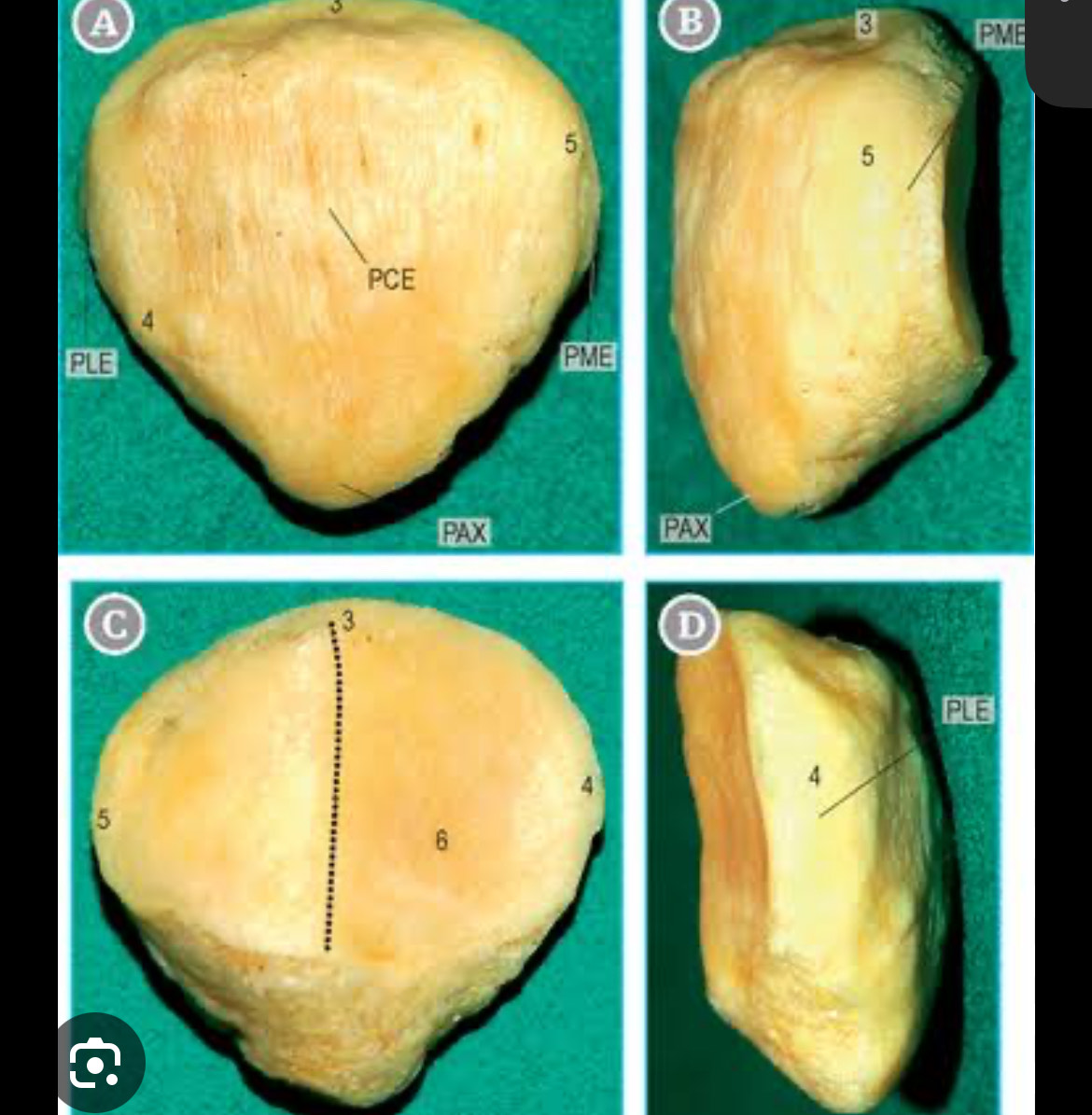 <p>what bone is this?</p>