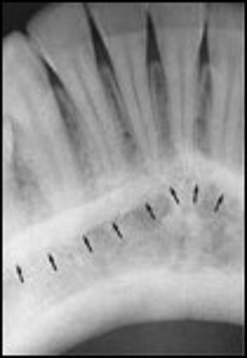 <p>Identify the radiopaque structure</p>