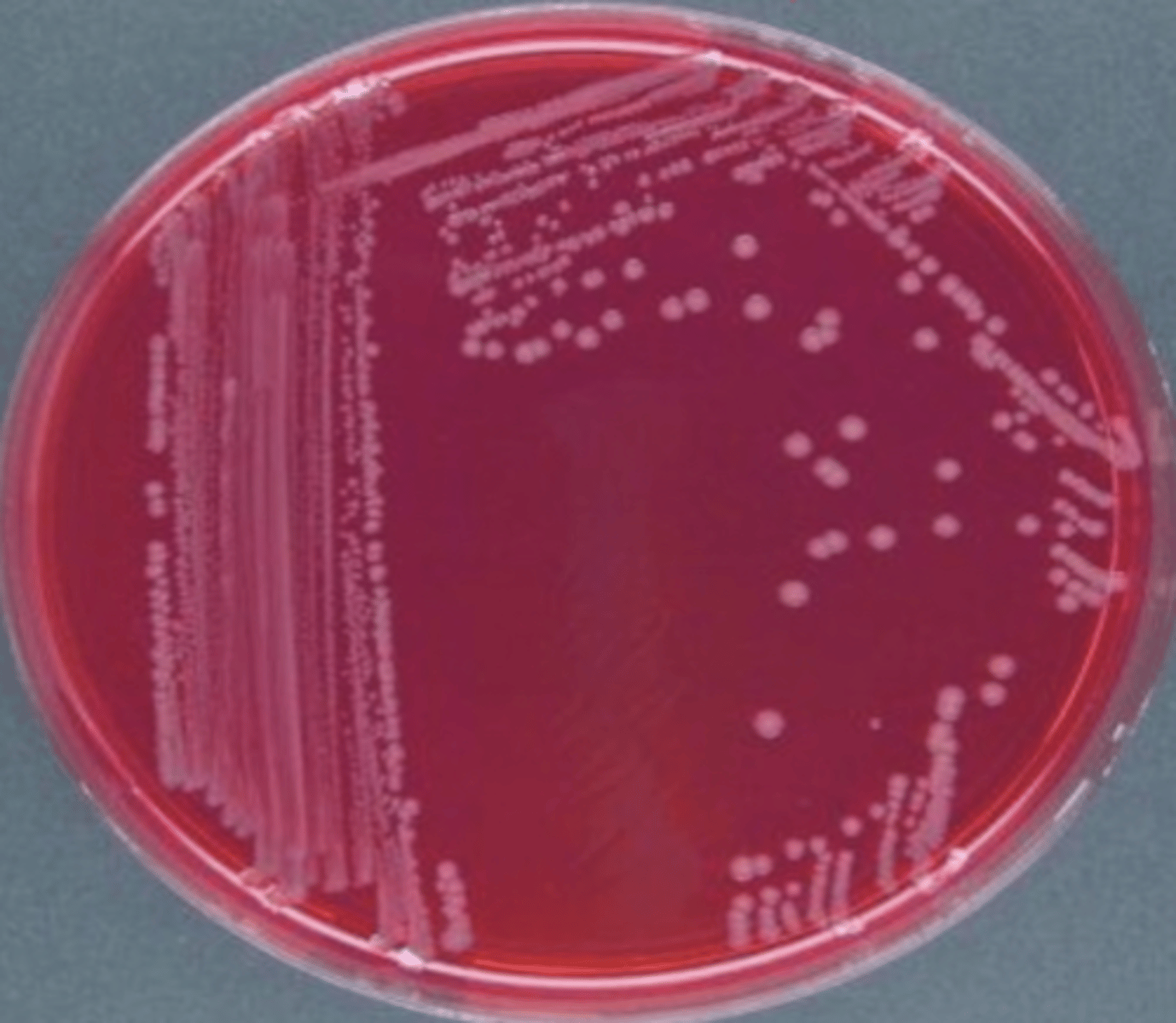 <p>which bacteria belonging to family Enterobacteriaceae produces pink colonies on brilliant green (BG) agar?</p>