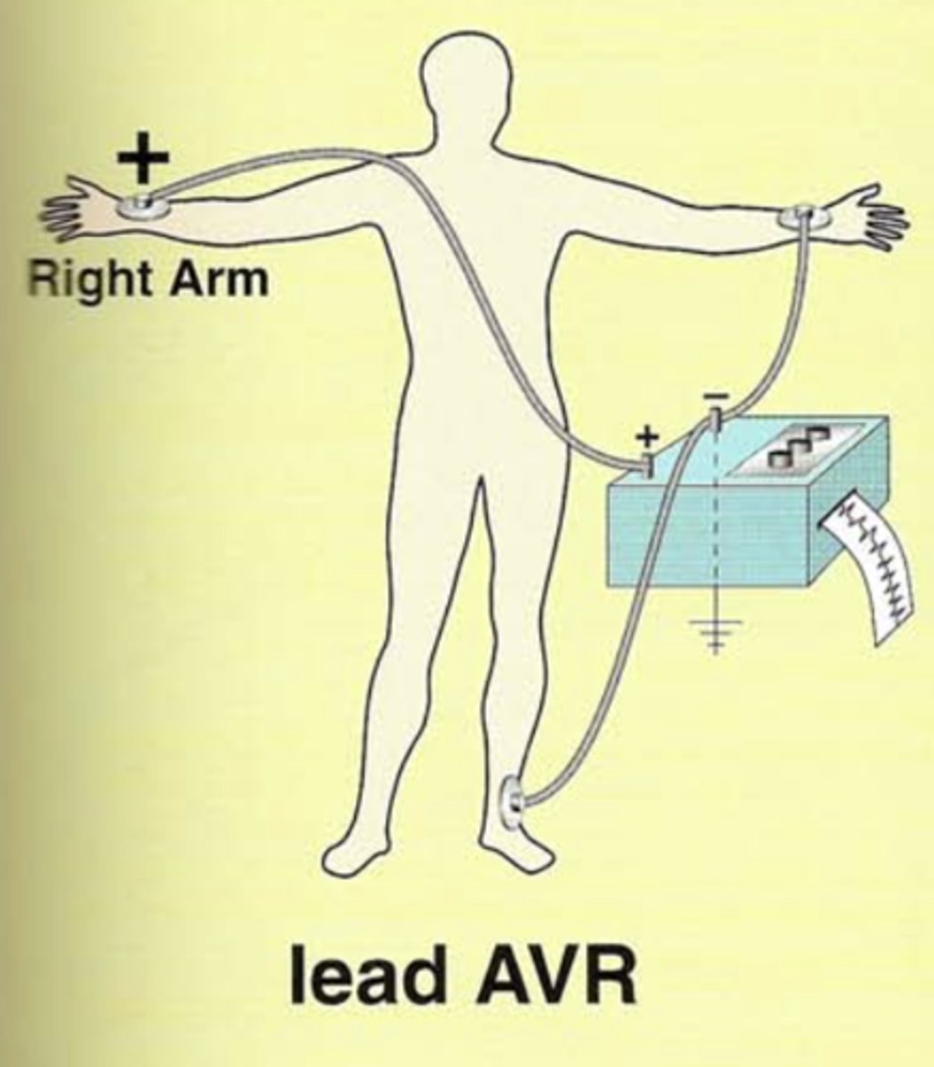 <p>Augmented/amplified, Voltage, Right arm</p><p>Right arm electrode is positive.</p><p>The remaining two are negative. </p>
