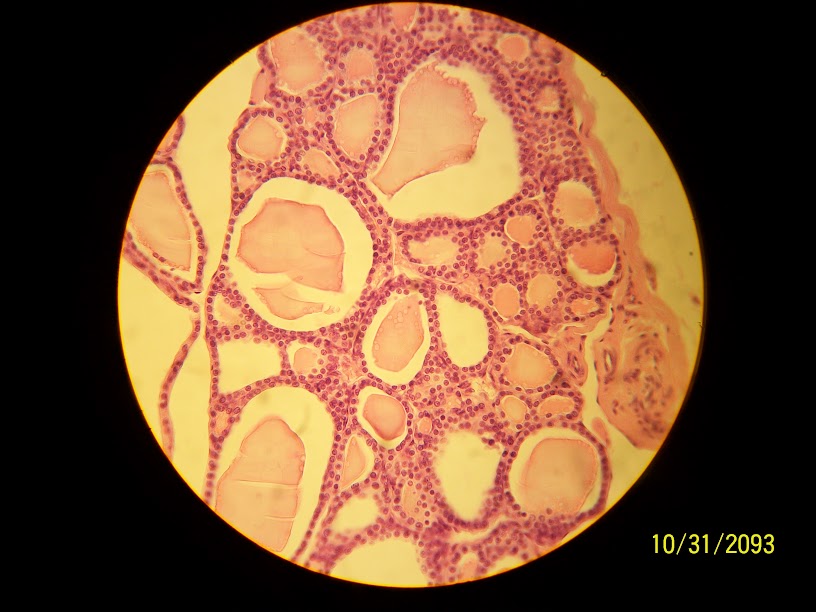 <p>Glandular Epithelium</p>