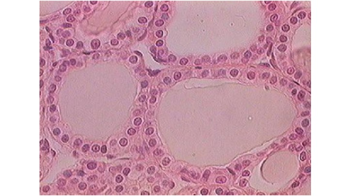 <p>This tissue being destroyed by an autoimmune disease would cause the patient to…</p>