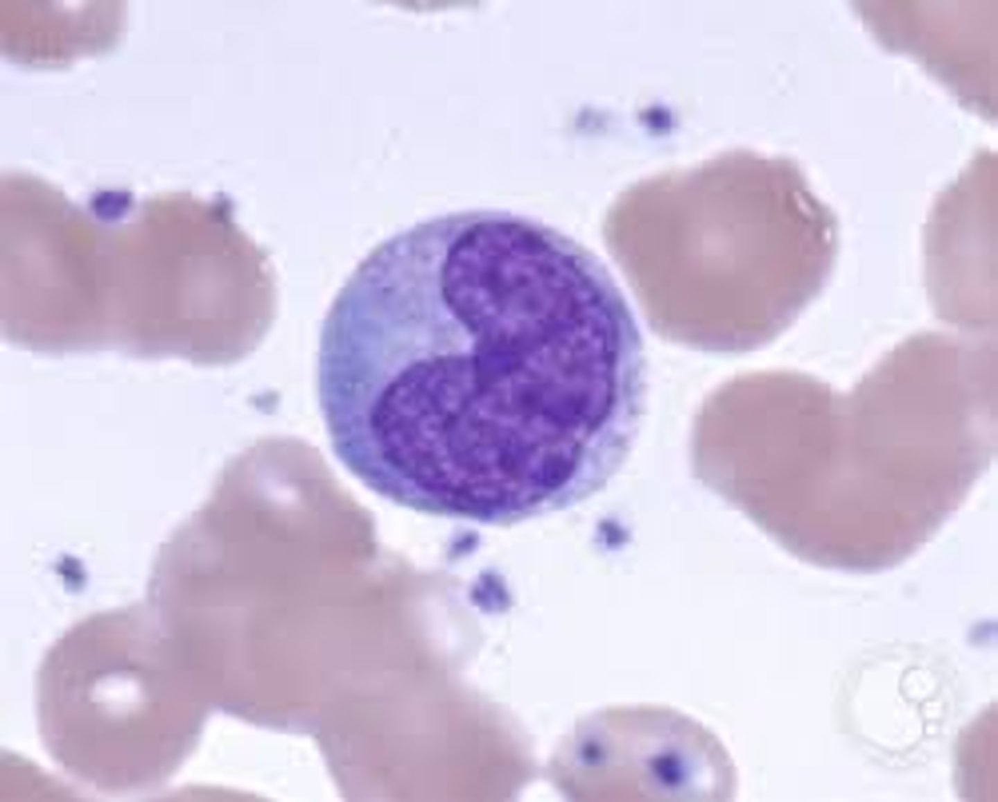 <p>Agranular</p><p>Largest WBC</p><p>Kidney-shaped nucleus</p><p>Can leave blood and enter the surrounding tissue (becoming macrophages) </p><p>produced in the bone marrow</p><p>Viral or fungal infections</p>