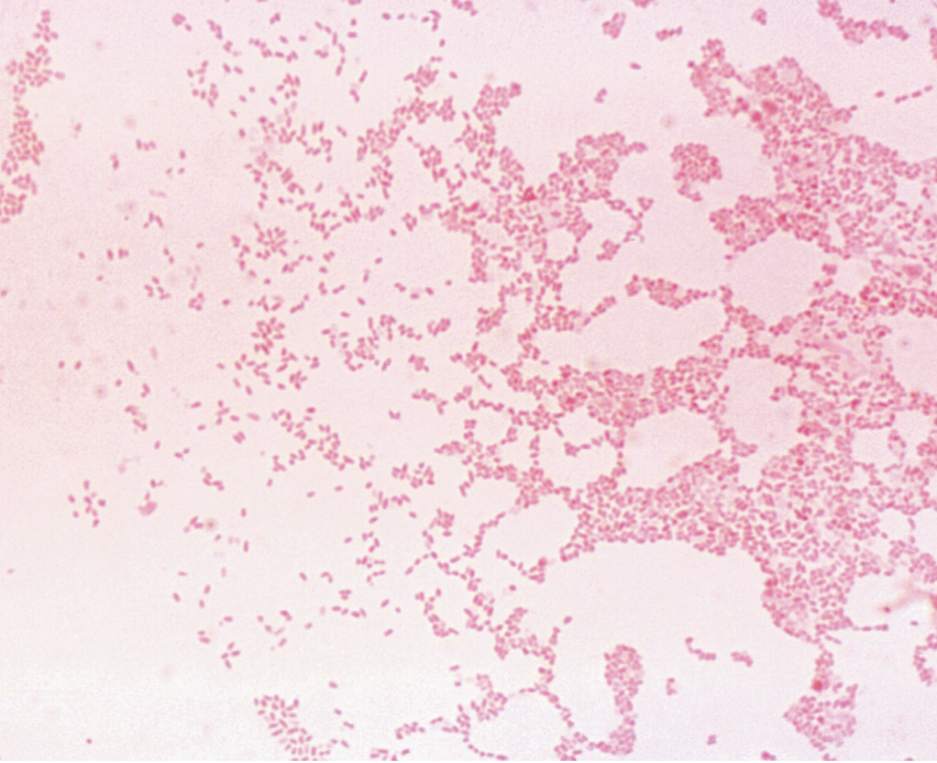 <ul><li><p>GNR</p></li><li><p> Stain irregularly and pale with Gram stain</p></li><li><p> Coccobacillary forms dominate in early cultures</p></li><li><p> Bipolar staining sometimes observed</p></li></ul><p></p>