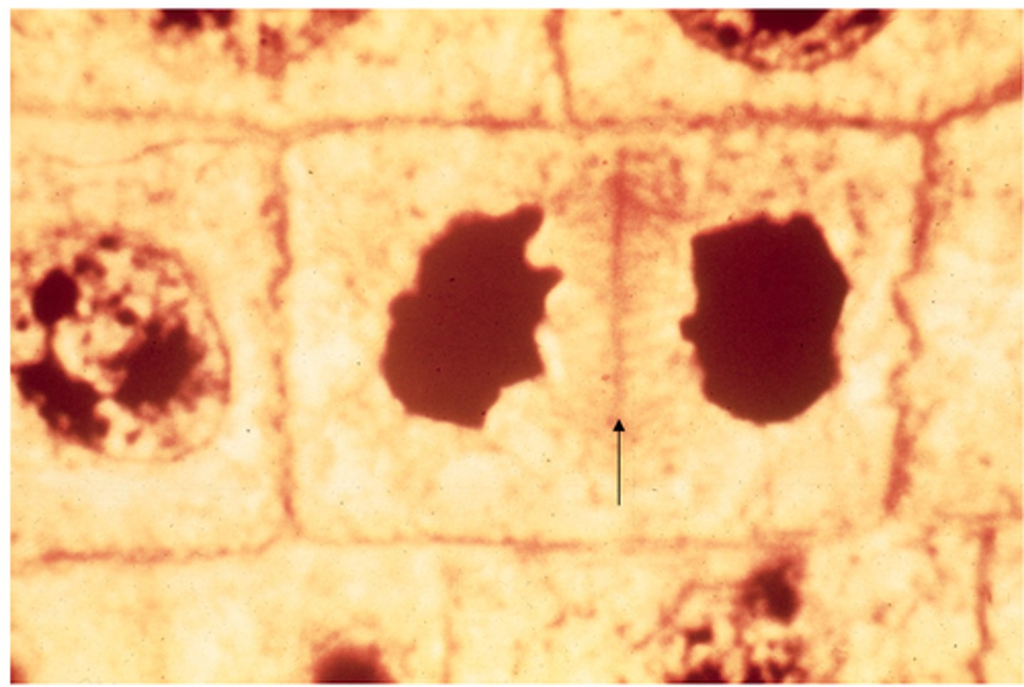 <p>This shows ________ in onion cells.</p>