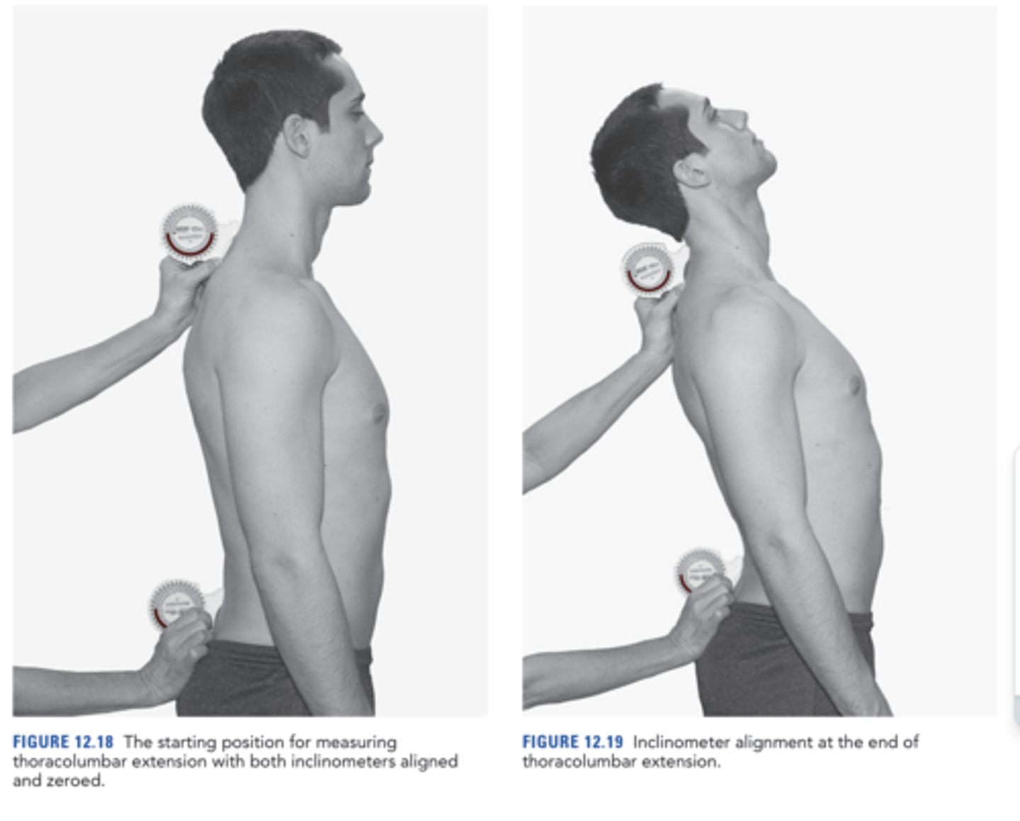 <p>T1 and S2 <br><br>normal = 25<br><br>MARK ON PARTNER THE LANDMARKS</p>