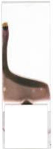 <p>What is this blood film appearance, and what is the cause/solution?</p>