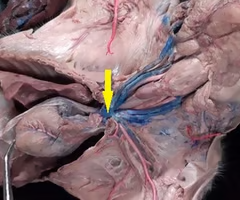 <p>What is the arrow pointing to? What’s it function? </p>