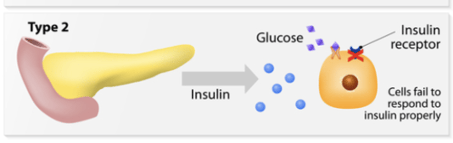 <p>occurs due to insulin resistance (when the body does not respond well to insulin) </p><p>tends to develop at an older age </p><p>can be prevented with lifestyle changes </p><p>can be managed with lifestyle modifications alone if diagnosed early </p>