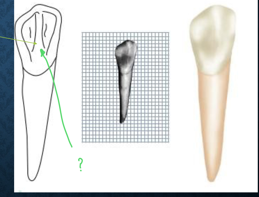<p>only present on linguals of permanent canines. runs along two fossae</p>