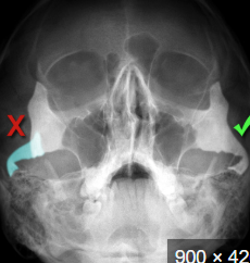 <p>what is this, its description and its appearance on images</p>