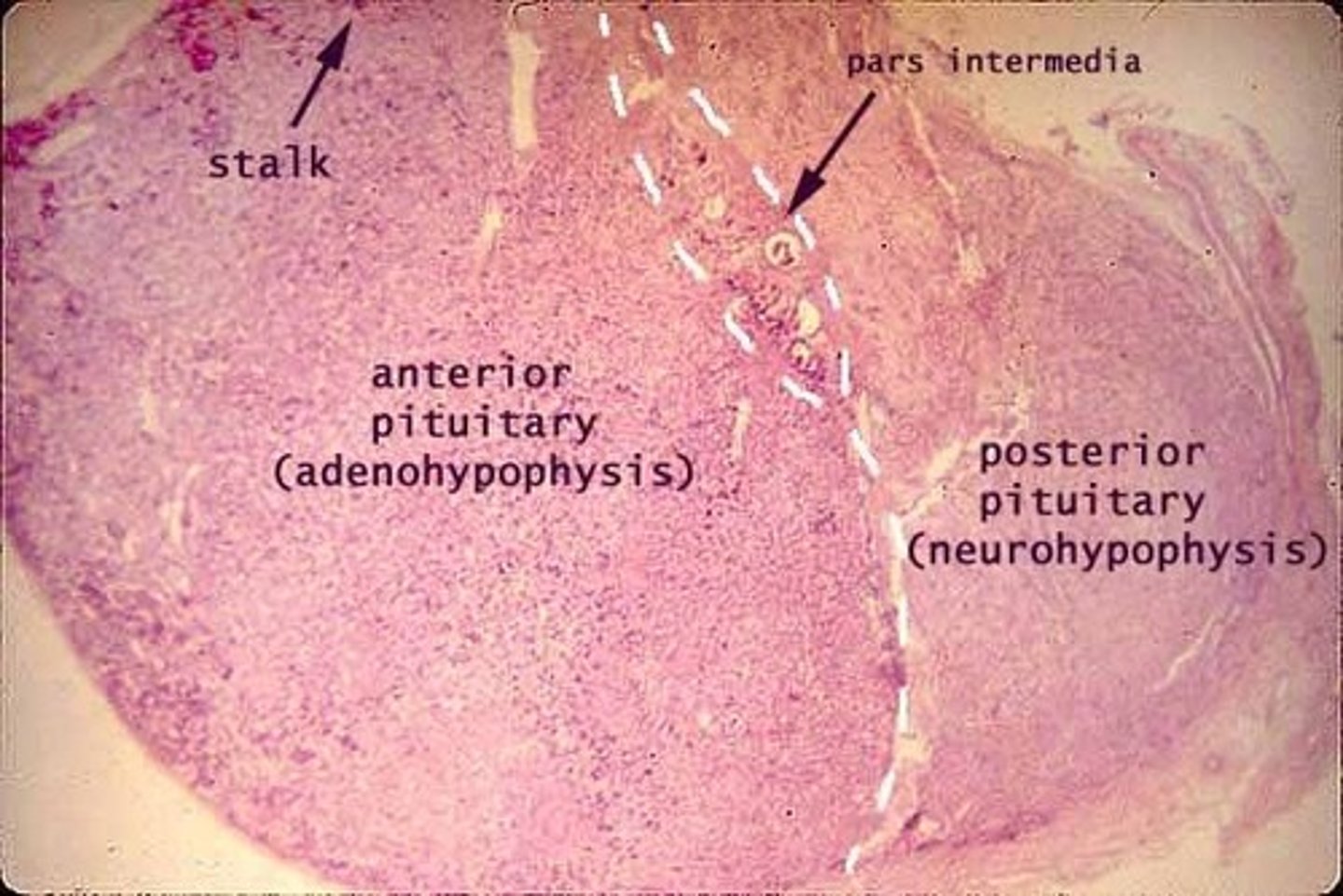 <p>Neural tissue (part of the brain)</p>