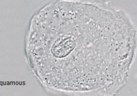 <p>Epithelial cell from urethra</p><ul><li><p>largest of epithelial cell</p></li><li><p>no pathology if found in urine</p></li></ul><p></p>
