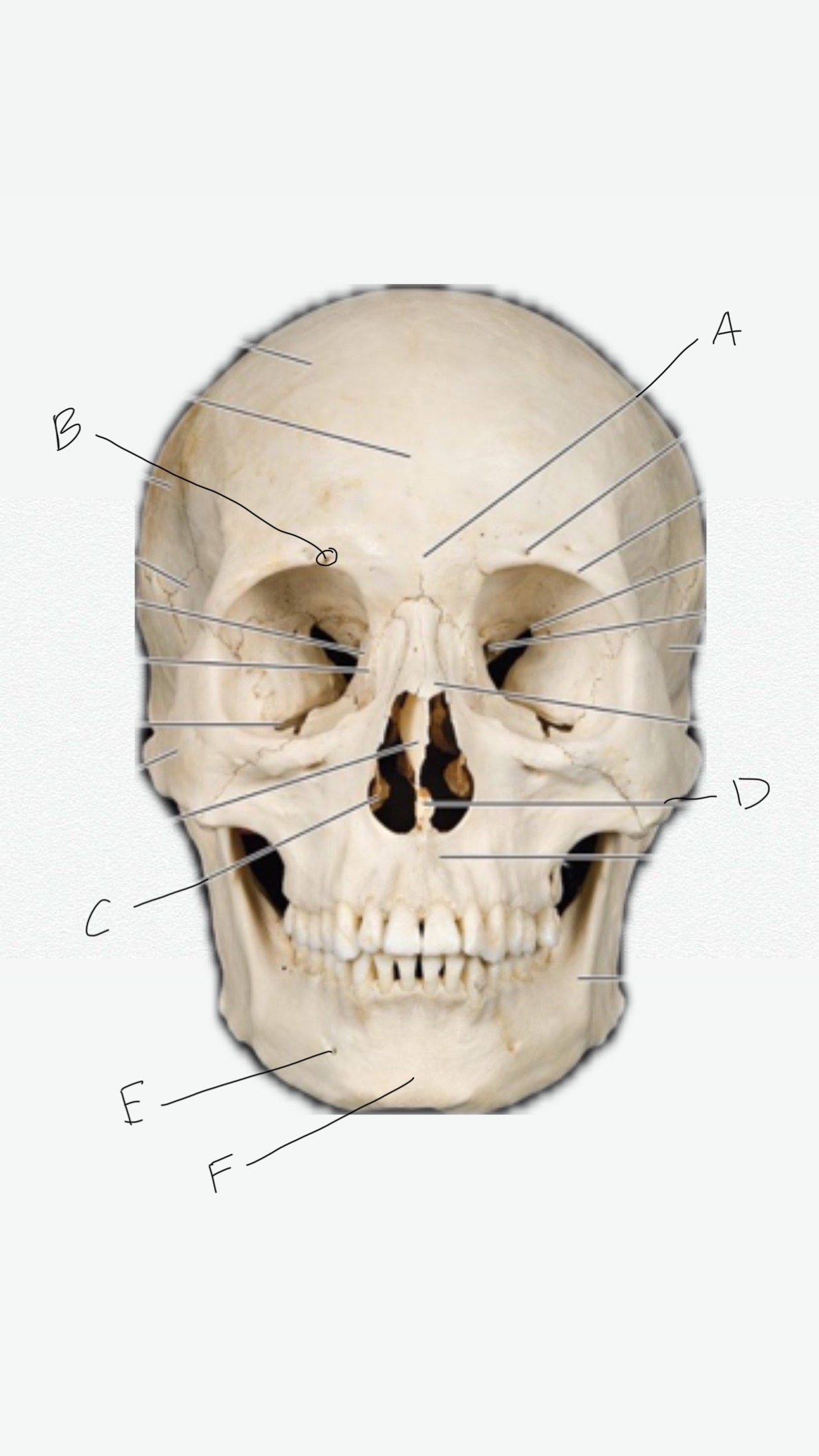 <p>B</p>
