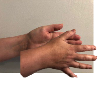 <p>Identify the Cranial Strain Pattern:</p>