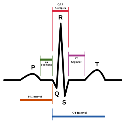 <p>beginning of ventricular depolarisation - impulse travels along interventricular septum within the AV bundle and the bundle branches to the Purkinje fibres, and by the moderator band to the papillary muscles of the right ventricle. </p>