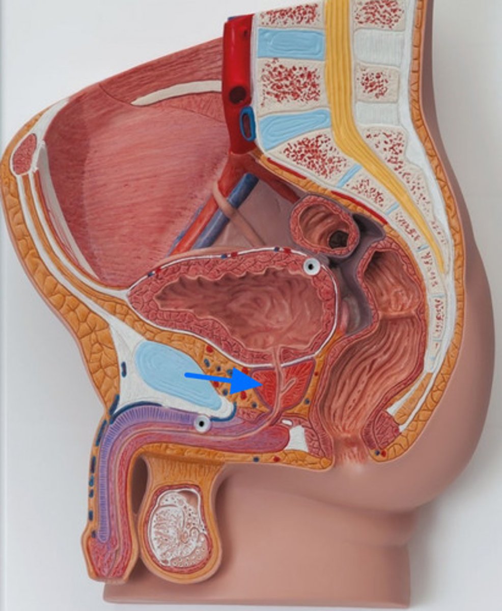 <p>ID Structure Marked with the Blue Arrow</p>