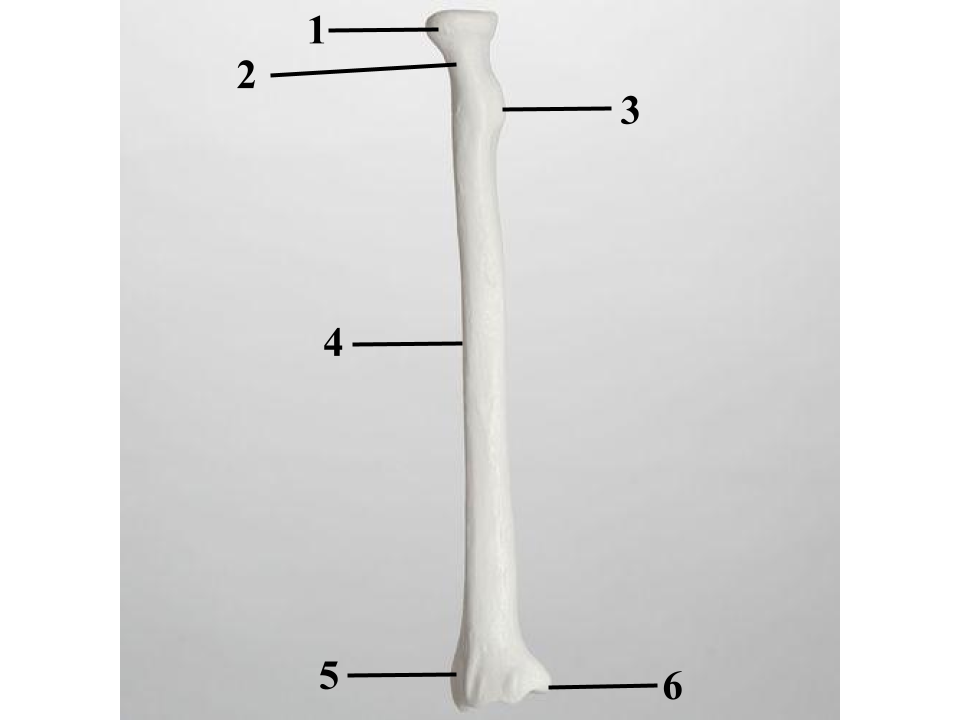 <p>What structure is indicated by 6?</p>